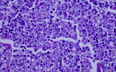 Blastomycosis After Flood Damage: What You Need to Know