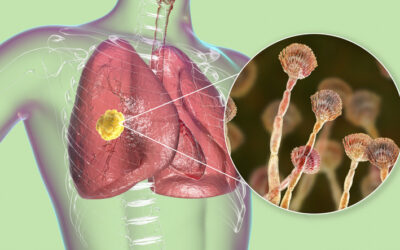 Understanding Indoor Mycotoxins and Their Harmful Effects on Your Body